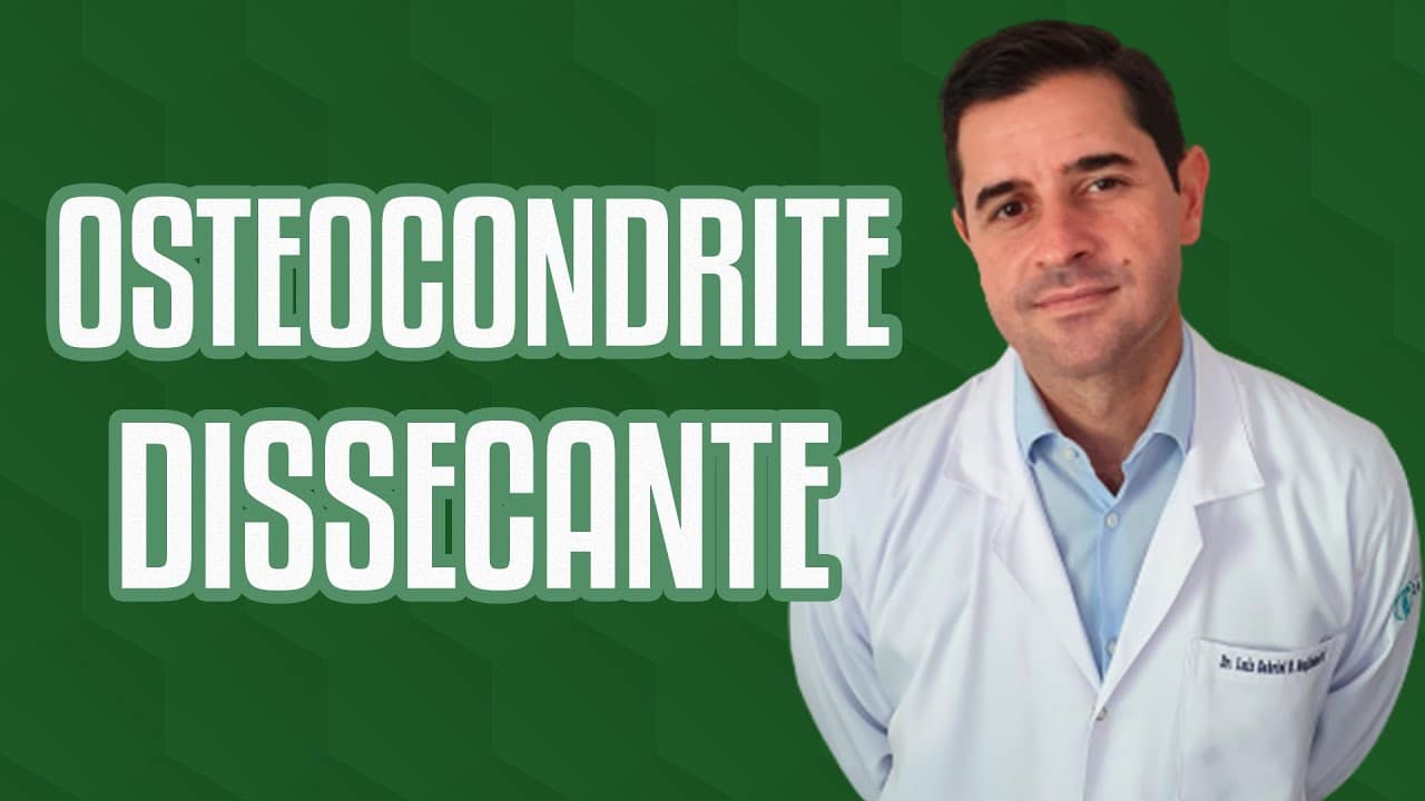 Ortopedista Especialista em Joelho Dr. Luiz Gabriel Atendimento de Alto Padrão em Ortopedia do Joelho. Realização de Cirurgias e Procedimentos. Experiência e Dedicação. Resultados Precisos. Osteocondrite dissecante no joelho