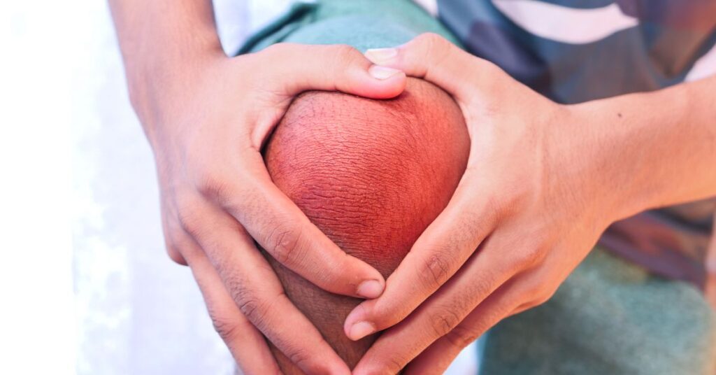 Ortopedista Especialista em Joelho Dr. Luiz Gabriel Atendimento de Alto Padrão em Ortopedia do Joelho. Realização de Cirurgias e Procedimentos. Experiência e Dedicação. Resultados Precisos. 4 1 Tratamento de Artrose do Joelho SP | Ortopedista Especialista em Joelho Dr. Luiz Gabriel | Atendimento de Alto Padrão em Ortopedia do Joelho. Realização de Cirurgias e Procedimentos. Experiência e Dedicação. Resultados Precisos.