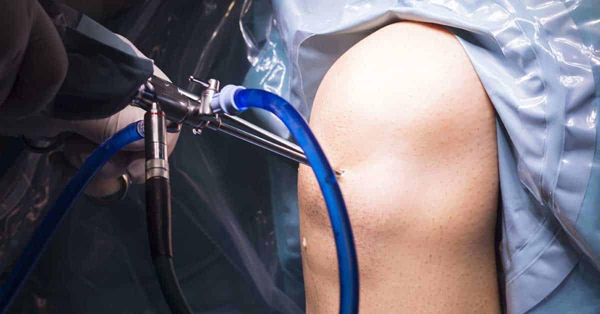 Ortopedista Especialista em Joelho Dr. Luiz Gabriel Atendimento de Alto Padrão em Ortopedia do Joelho. Realização de Cirurgias e Procedimentos. Experiência e Dedicação. Resultados Precisos. Artroscopia do joelho: cirurgia minimamente invasiva em São Paulo